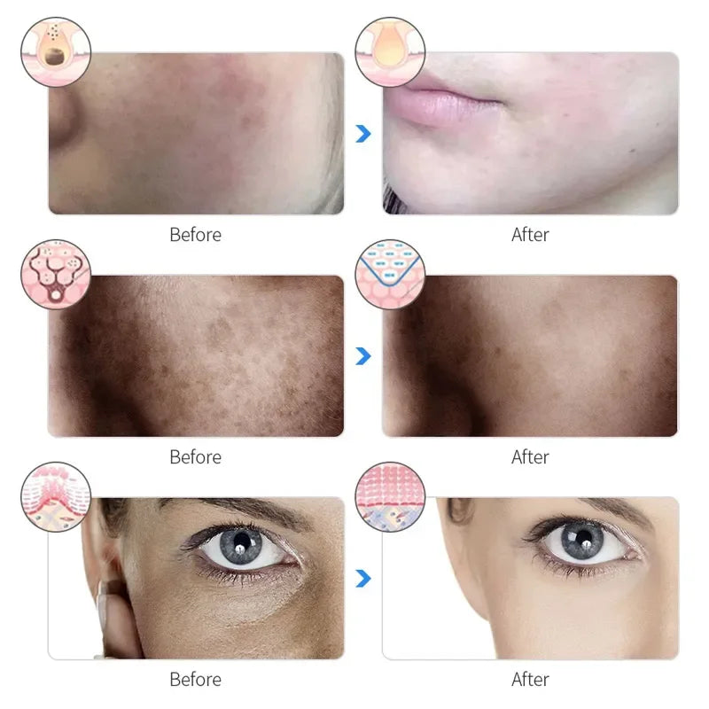 Fémica™ LED GlowMask